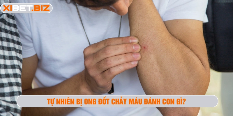 Tự nhiên bị ong đốt chảy máu đánh con gì